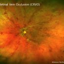 대연본안과의원 이미지