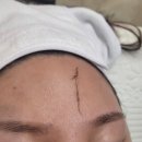 [미작뷰티 -하남점]하남피부관리 스킨플래닝 후기입니다