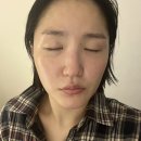 보문역-바이오폭스 에너지테라피 웨딩관리후기_전후 사진O(엑스날 보문점)