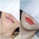 엠에스(ms)헤어 | 강남 입술반영구 후 입술이 예뻐졌는데도 만족하지 못하는 이유