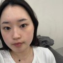 로더에스테틱 - 전주시 덕진구 | 전주 피부관리 로더에스테틱 물방울리프팅 후기 속건조고민해결