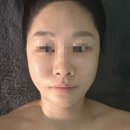 피부향기 스킨앤바디 | 대구 달서구 피부관리 전문점 비젼스킨앤바디 내돈내산 솔직후기