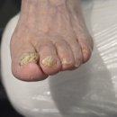 제천내성발톱 관리 잘해주시는 푸스케어 롯데마트제천점에 다녀왔어요.