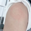 [20대 여자] 진접 아산 내과에서 모더나 2차 백신 접종 후기