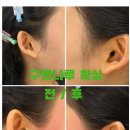 달리왁싱 | 인계동 구레나룻 왁싱 문결 왁싱 후기
