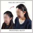 에르모사뷰티 두피문신아카데미 | 울산두피문신후기 - 가르마탈모 때문에 스트레스