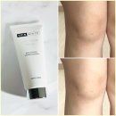 크림 스킨바디 | 바디착색크림 스킨화이트 바디 멜라닌크림 변화 후기