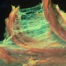 리커버 운동센터 이미지