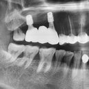 진천치과기공소 이미지