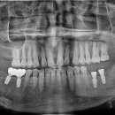 포곡치과의원 이미지