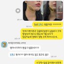 참  샘 | [•뷰티·제품] 사각턱 + 턱밑샘 보톡스 내돈내산 후기, 부작용&amp;효과