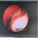 수성함소아한의원 | 대구 함소아한의원, 비염이 오래가는 아이 특징과 확인해야 할 점