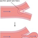 피지오컨디셔닝운동센터 네이버블로그