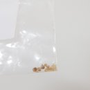 가든비뇨기과의원 | 요로결석 재발후기 대학병원 내시경수술, 비뇨기과 쇄석술 !!