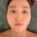 현스킨케어 - 하남시 | 현스킨앤바디 대구남산역점 트러블 피부 진정 스킨케어 후기