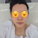 잰에스테틱 | 연제구에스테틱 출산 후 무너진 탄력 회복 피부관리 장인 박소현에스테틱 리얼 솔직후기