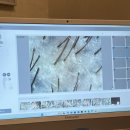 JW메디 | 세종 두피케어 재생기기까지 꼼꼼했던 WT메소드 세종점 리얼 후기