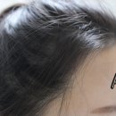 은혜헤어라인 이미지