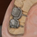 민치과기공소 이미지