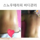 핫테라피 이미지