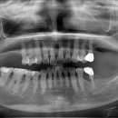비우고채우는치과의원 이미지