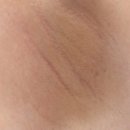 한시까지약국 | 겨드랑이 착색 색소침착 약국 연고 대신 미백 크림 관리 후기