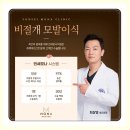 1463 | 여성 헤어라인교정 비절개모발이식1463모낭 정확히 7개월차 수술후기 by 강남역 비절개 모발이식전문...