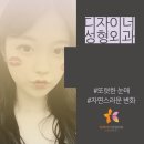 디자이너성형외과의원 | 비절개눈매교정후기 신중하게 따져봐요~