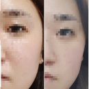 에스엠브로우
