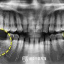 청주으뜸치과의원 이미지