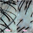 래미안해운대아파트경로당 | 해운대 장산 에스테틱 추천 올가드림뷰티 해운대래미안점 두피디톡스 후기