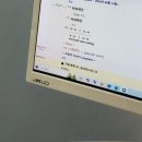 강서구-15 | [교정일기] 20대 클리피씨 발치교정 15개월차 후기/ 강서구 교정치과 추천/ 비교샷 첨부