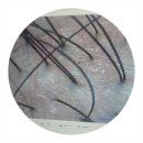 케어하우스 | 용인 광교 상현역탈모 더케어하우스 광교두피관리 리얼 후기