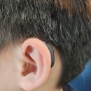 세종유 | 세종시보청기 초등학생 난청인 포낙 양쪽 착용 후기