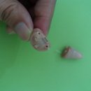 대구소리샘보청기 이미지