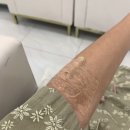 조현철내과의원 | [김포 사우동 내과] ‘조현철 내과’ 대장 + 위내시경 수면마취 후기