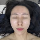 다산피부관리 모공관리 필링전문 <더블제이뷰티> 후기