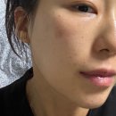 진 | 원진피부과에서 만든 WJ코스메틱으로 바꾸고 피부 깨끗해진 후기