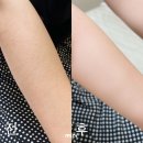 여자 왁싱 털 제모 팔다리 왁싱 후 관리 구로 신도림 왁싱라운지