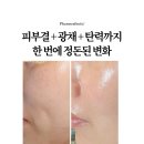 1회 15만원 LDM 시술, 집에서 무제한으로? 슈퍼젝션 디바이스 원장 직접 사용 후기