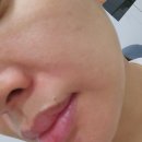 인셀덤남양주 - 남양주시 다산중앙로123번길 22-26 | 천안 피부관리/천안 피부관리 체험_인셀덤 피부관리체험 후기 Part.1 #천안 불당동 인셀덤