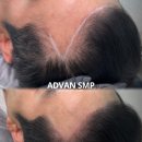어드반SMP 이미지