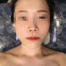 영등포메디칼약국 | 영등포역 에스테틱 마리앙에스테틱에서 윤곽관리 받은 후기