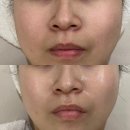 대구 신부관리 탄력과 광이 생기는 저자극 플로우테라피