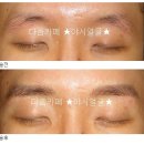 예쁜야시 네이버블로그