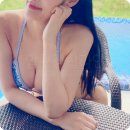 팔뚝지방흡입 후기 민소매가 기다려지는 팔뚝라인