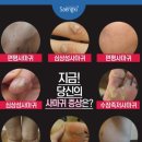 [공지] 2024년 나에게 주는 선물! 생애 첫 피부과! 차앤유 테트라점빼기!