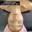 피부맑음 이미지