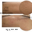 뷰티 포엠 네이버블로그