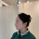 November : 파주 금릉역 피부관리 : 씰스킨 feat. 롱펄스 초음파 원쎄라 리프팅 후기